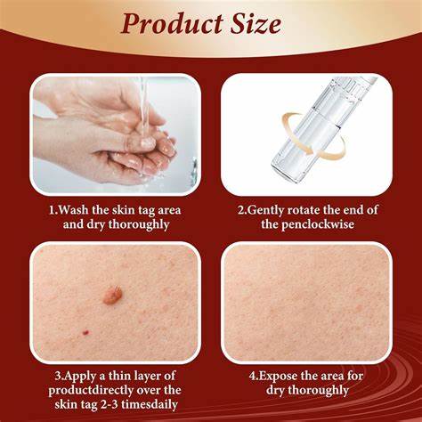 Tags & Moles Remover
