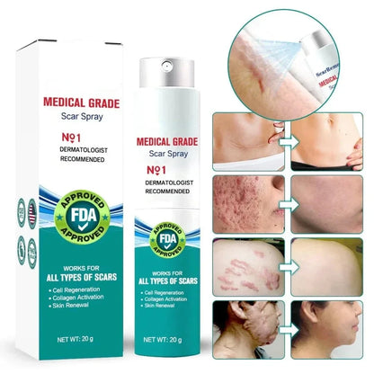 Scar Spray