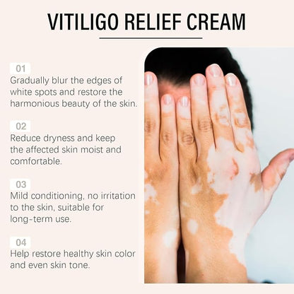 Vitiligo Removal Cream